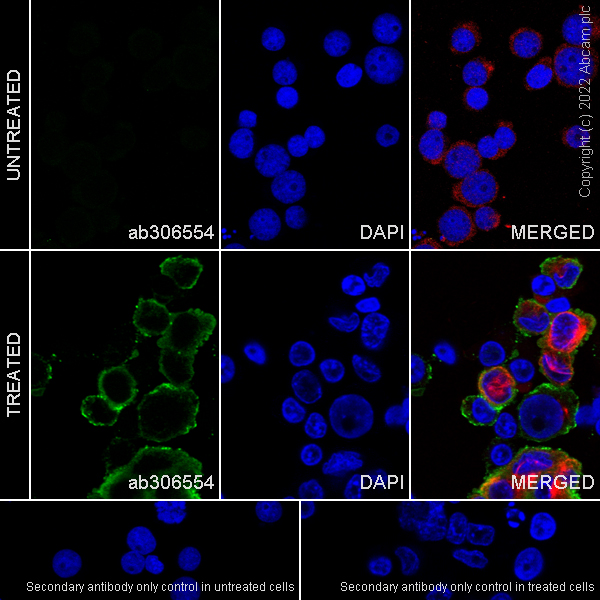 Immunocytochemistry/ Immunofluorescence - Anti-CMKLR1 antibody [EPR26501-70] (ab306554), expandable thumbnail