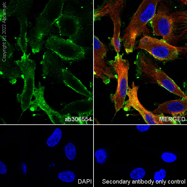 Immunocytochemistry/ Immunofluorescence - Anti-CMKLR1 antibody [EPR26501-70] - BSA and Azide free (AB306555)