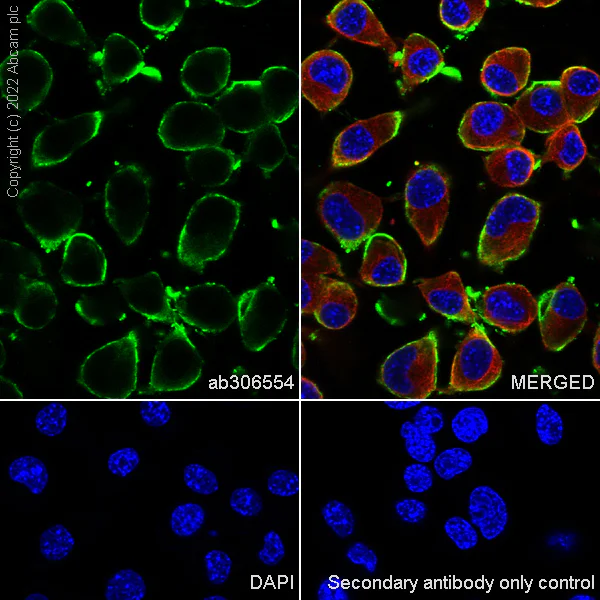 Immunocytochemistry/ Immunofluorescence - Anti-CMKLR1 antibody [EPR26501-70] - BSA and Azide free (AB306555)