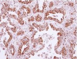Immunohistochemistry (Formalin/PFA-fixed paraffin-embedded sections) - Anti-CML66 antibody (AB126902)