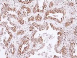 Immunohistochemistry (Formalin/PFA-fixed paraffin-embedded sections) - Anti-CML66 antibody (AB126902)