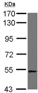 Western blot - Anti-CML66 antibody (AB126902)