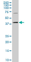 Western blot - Anti-CMPK2 antibody (AB194567)