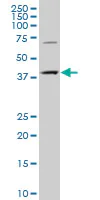 Western blot - Anti-CMPK2 antibody (AB194567)