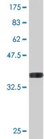 Western blot - Anti-CMPK2 antibody (AB194567)