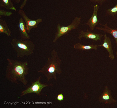 Anti-CMT2 antibody [EPR9584]