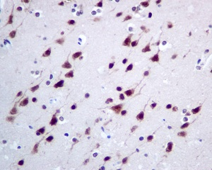 Immunohistochemistry (Formalin/PFA-fixed paraffin-embedded sections) - Anti-CMT2 antibody [EPR9584] (AB150363)