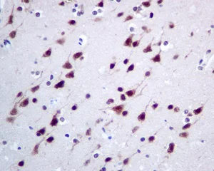 Immunohistochemistry (Formalin/PFA-fixed paraffin-embedded sections) - Anti-CMT2 antibody [EPR9584] (AB150363)