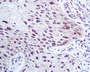 Immunohistochemistry (Formalin/PFA-fixed paraffin-embedded sections) - Anti-CMT2 antibody [EPR9584] - BSA and Azide free (AB248941)
