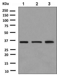 Western blot - Anti-CMT2 antibody [EPR9584] - BSA and Azide free (AB248941)