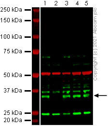 Western blot - Anti-CMT2 antibody [EPR9584] - BSA and Azide free (AB248941)