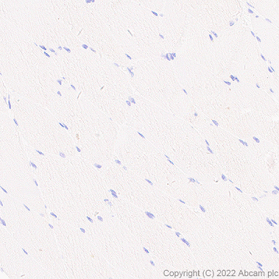 Immunohistochemistry (Formalin/PFA-fixed paraffin-embedded sections) - Anti-CMTM4 antibody [EPR27409-50] (AB307501)
