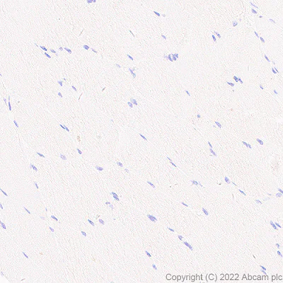Immunohistochemistry (Formalin/PFA-fixed paraffin-embedded sections) - Anti-CMTM4 antibody [EPR27409-50] (AB307501)