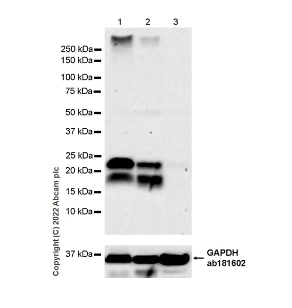 Western blot - Anti-CMTM4 antibody [EPR27409-50] (AB307501)