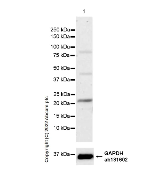 Western blot - Anti-CMTM4 antibody [EPR27409-50] (AB307501)
