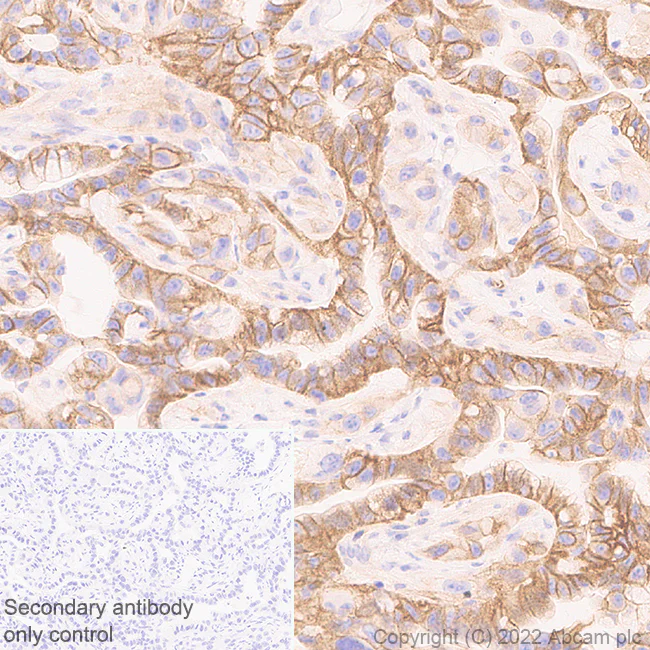 Immunohistochemistry (Formalin/PFA-fixed paraffin-embedded sections) - Anti-CMTM4 antibody [EPR27409-50] - BSA and Azide free (AB307502)
