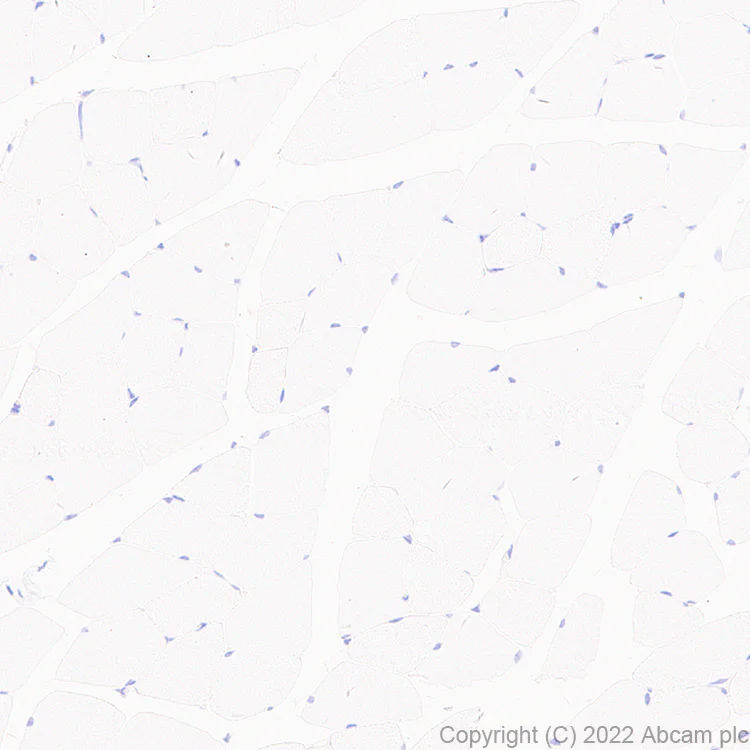 Immunohistochemistry (Formalin/PFA-fixed paraffin-embedded sections) - Anti-CMTM4 antibody [EPR27409-50] - BSA and Azide free (AB307502)