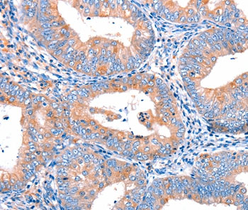 Immunohistochemistry (Formalin/PFA-fixed paraffin-embedded sections) - Anti-CMTM6 antibody - C-terminal (AB198284)