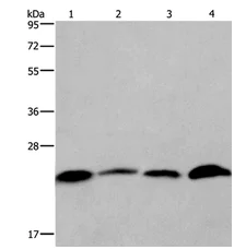Western blot - Anti-CMTM6 antibody - C-terminal (AB198284)