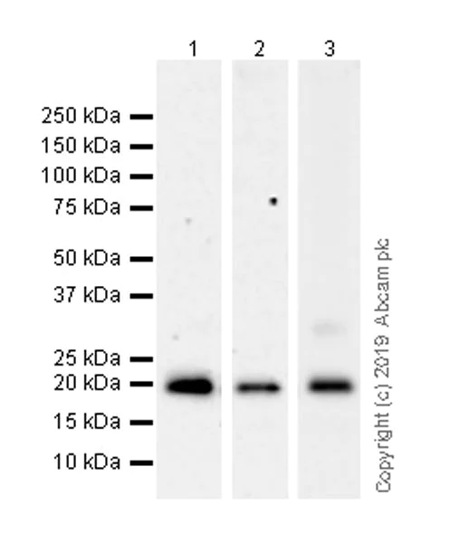 Western blot - Anti-CMTM6 antibody [EPR23015-45] (AB264067)