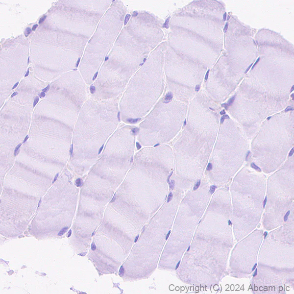 Immunohistochemistry (Formalin/PFA-fixed paraffin-embedded sections) - Anti-CMTM6 antibody [EPR23015-45] - BSA and Azide free (AB264076)