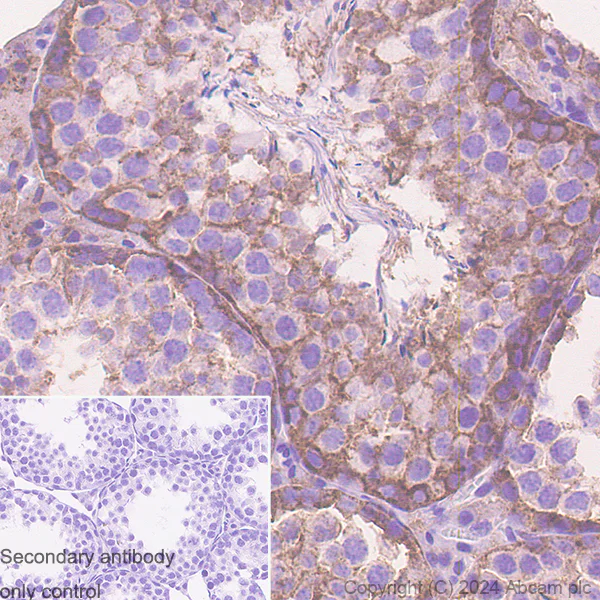Immunohistochemistry (Formalin/PFA-fixed paraffin-embedded sections) - Anti-CMTM6 antibody [EPR23015-45] - BSA and Azide free (AB264076)