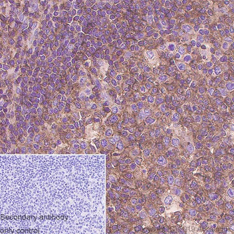 Immunohistochemistry (Formalin/PFA-fixed paraffin-embedded sections) - Anti-CMTM6 antibody [EPR23015-45] - BSA and Azide free (AB264076)
