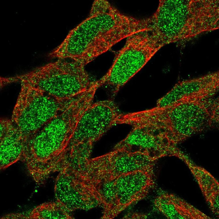 Immunocytochemistry/ Immunofluorescence - Anti-CNBP antibody (AB272676)