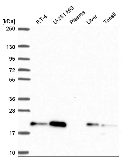 Western blot - Anti-CNBP antibody (AB272676)