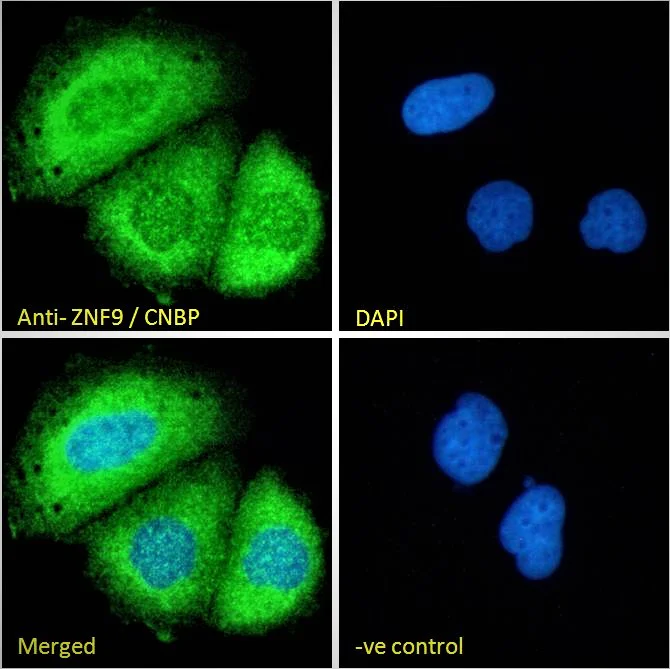 Immunocytochemistry/ Immunofluorescence - Anti-CNBP antibody (AB48027)