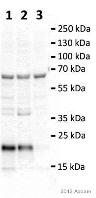 Western blot - Anti-CNBP antibody (AB48027), expandable thumbnail