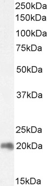 Western blot - Anti-CNBP antibody (AB48027), expandable thumbnail