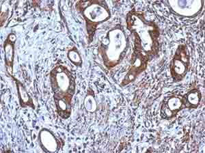 Immunohistochemistry (Formalin/PFA-fixed paraffin-embedded sections) - Anti-CNDP1/CN1 antibody (AB155315), expandable thumbnail
