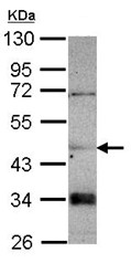 Western blot - Anti-CNDP2/CN2 antibody (AB101406)