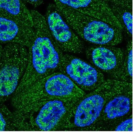 Immunocytochemistry/ Immunofluorescence - Anti-CNDP2/CN2 antibody (AB204351)