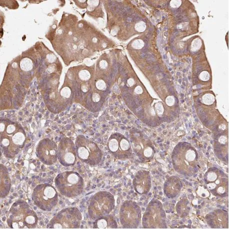 Immunohistochemistry (Formalin/PFA-fixed paraffin-embedded sections) - Anti-CNDP2/CN2 antibody (AB204351)