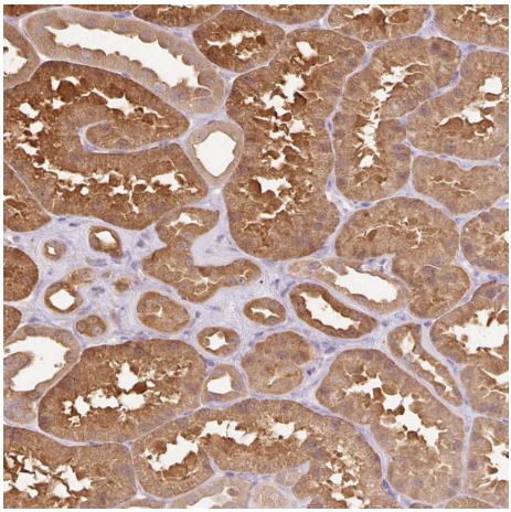 Immunohistochemistry (Formalin/PFA-fixed paraffin-embedded sections) - Anti-CNDP2/CN2 antibody (AB204351)