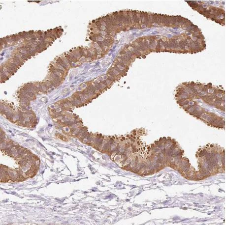 Immunohistochemistry (Formalin/PFA-fixed paraffin-embedded sections) - Anti-CNDP2/CN2 antibody (AB204351)