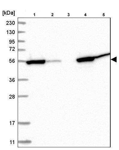 Western blot - Anti-CNDP2/CN2 antibody (AB204351)