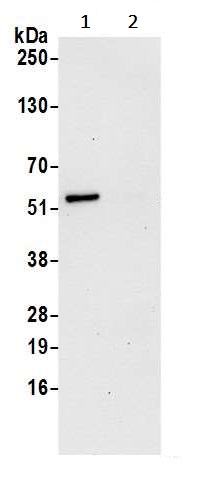 Immunoprecipitation - Anti-CNDP2/CN2 antibody (AB241126)