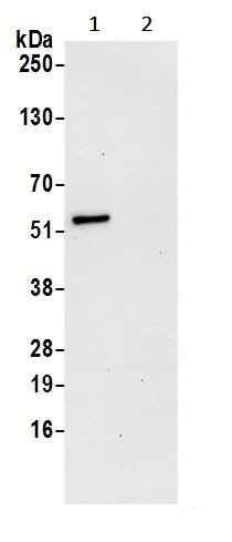 Immunoprecipitation - Anti-CNDP2/CN2 antibody (AB241126)