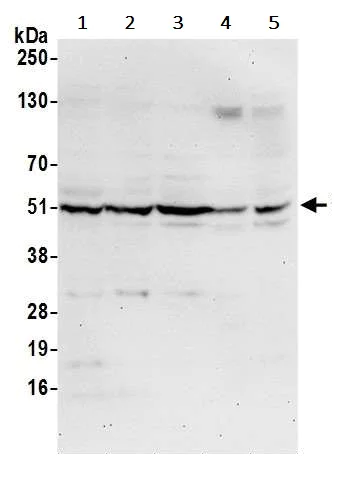 Western blot - Anti-CNDP2/CN2 antibody (AB241126)