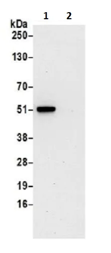 Immunoprecipitation - Anti-CNDP2/CN2 antibody (AB241216)