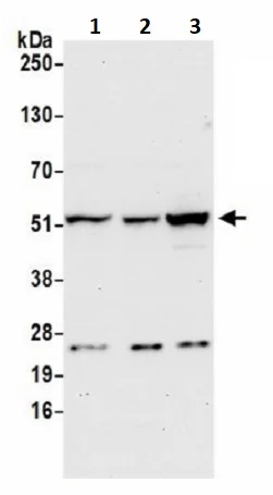 Western blot - Anti-CNDP2/CN2 antibody (AB241216)