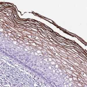 Immunohistochemistry (Formalin/PFA-fixed paraffin-embedded sections) - Anti-CNFN antibody (AB151047)