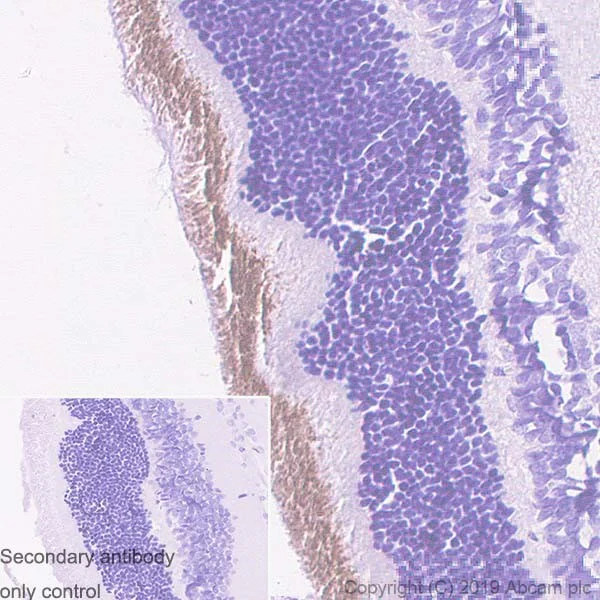 Immunohistochemistry (Formalin/PFA-fixed paraffin-embedded sections) - Anti-CNGA1 antibody [PMc 1D1] (AB253296)