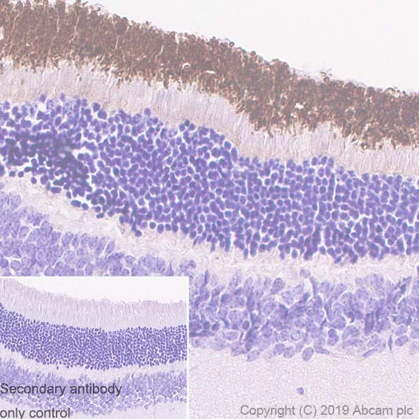 Immunohistochemistry (Formalin/PFA-fixed paraffin-embedded sections) - Anti-CNGA1 antibody [PMc 1D1] (AB253296)