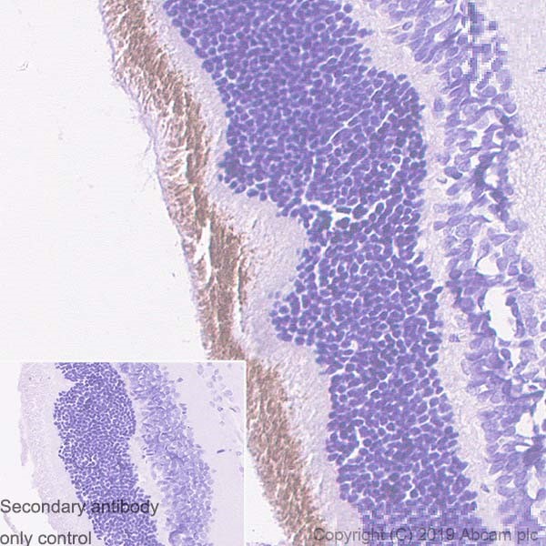 Immunohistochemistry (Formalin/PFA-fixed paraffin-embedded sections) - Anti-CNGA1 antibody [PMc 1D1] - BSA and Azide free (AB255766), expandable thumbnail