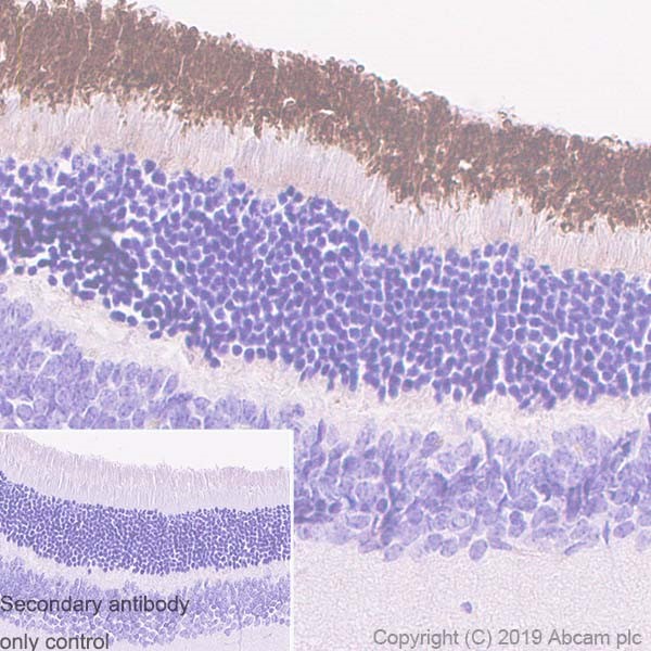 Immunohistochemistry (Formalin/PFA-fixed paraffin-embedded sections) - Anti-CNGA1 antibody [PMc 1D1] - BSA and Azide free (AB255766), expandable thumbnail