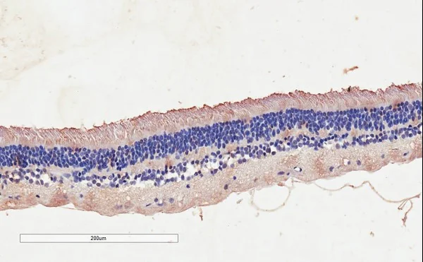 Immunohistochemistry (Formalin/PFA-fixed paraffin-embedded sections) - Anti-CNGB3 antibody (AB239223)